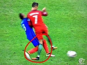 Cristiano Ronaldo Injury in final EURO 2016